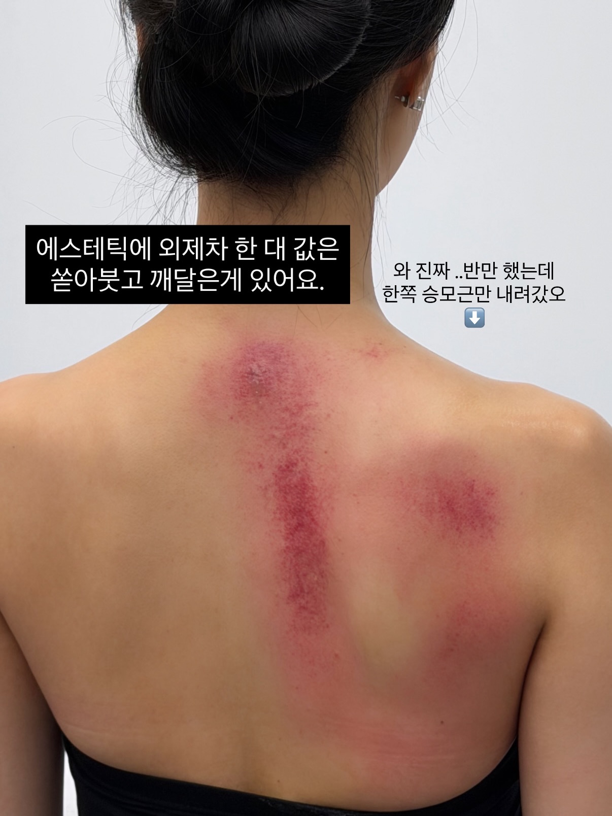 아이올 홈케어 고주파 기기