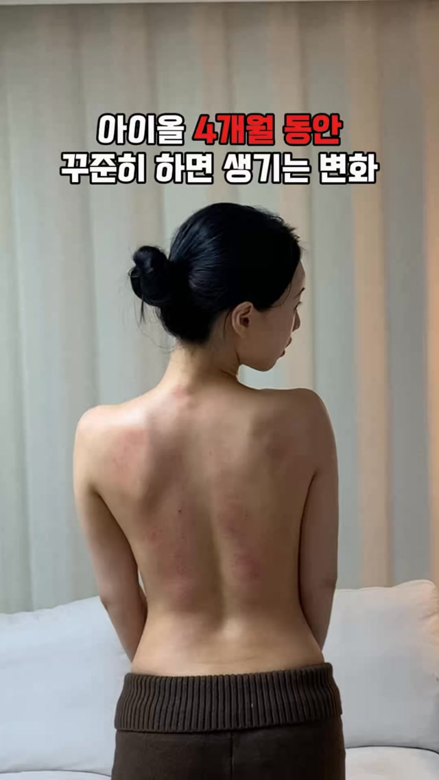 아이올 홈 리프팅 디바이스