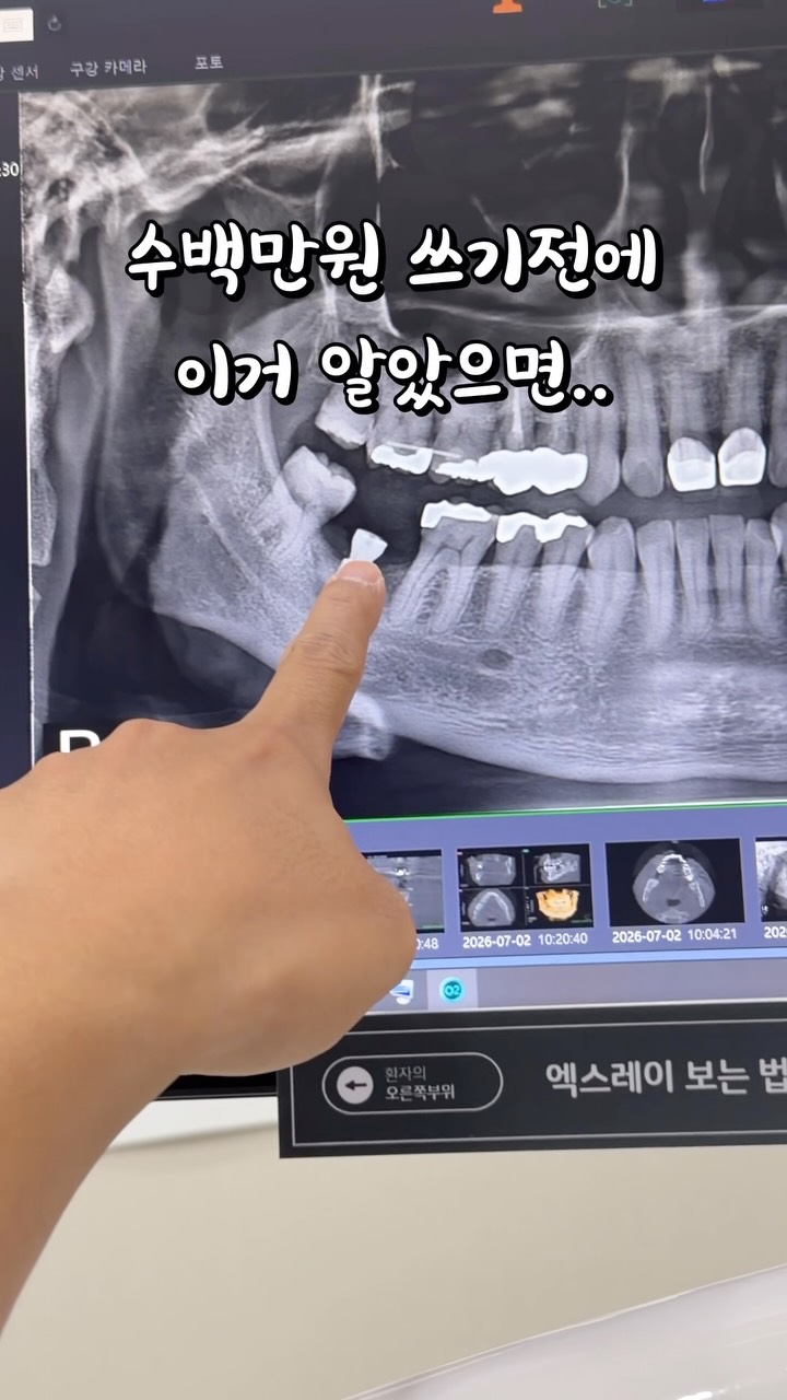클린디 전동칫솔