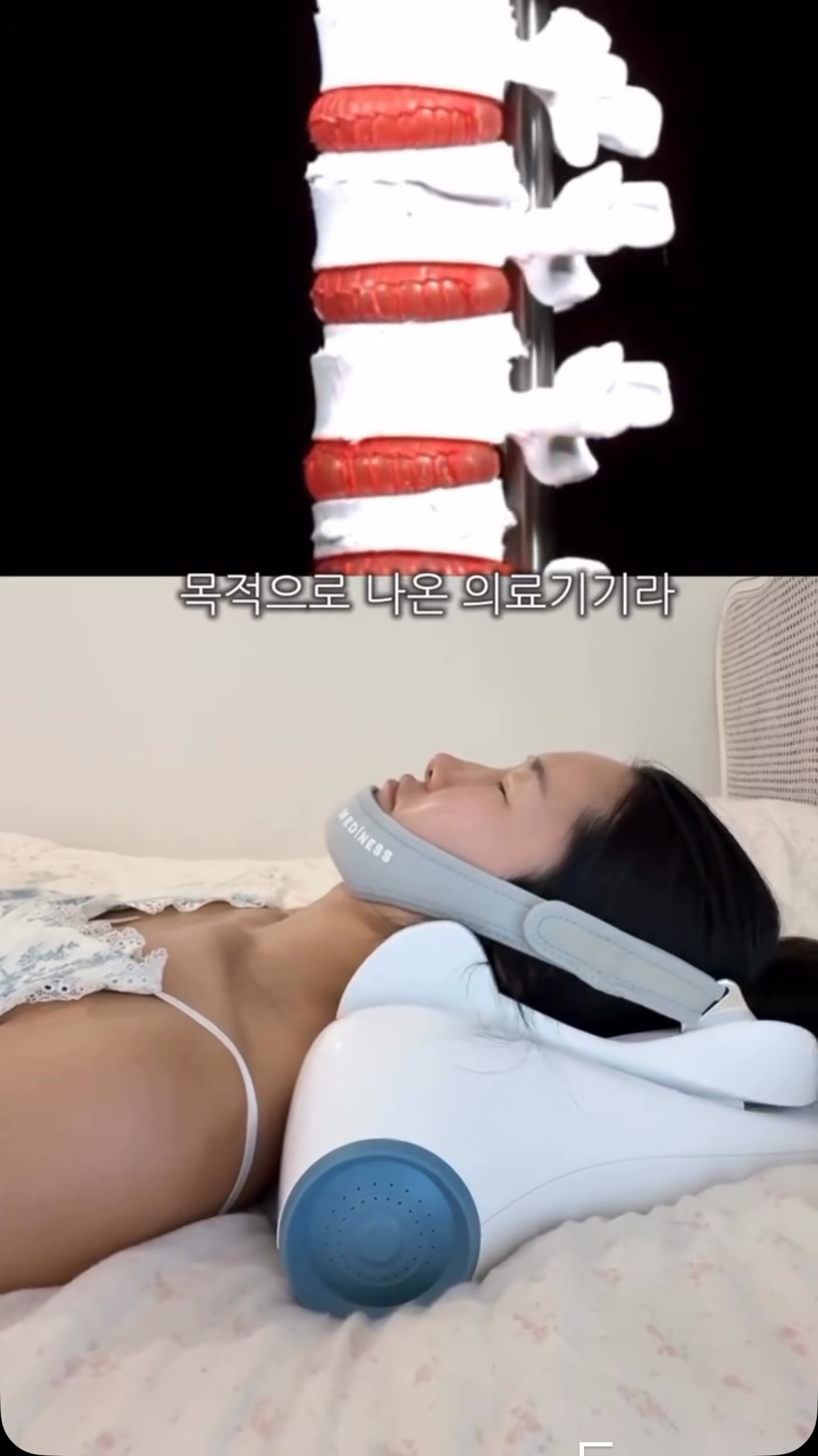 넥필 목 견인기