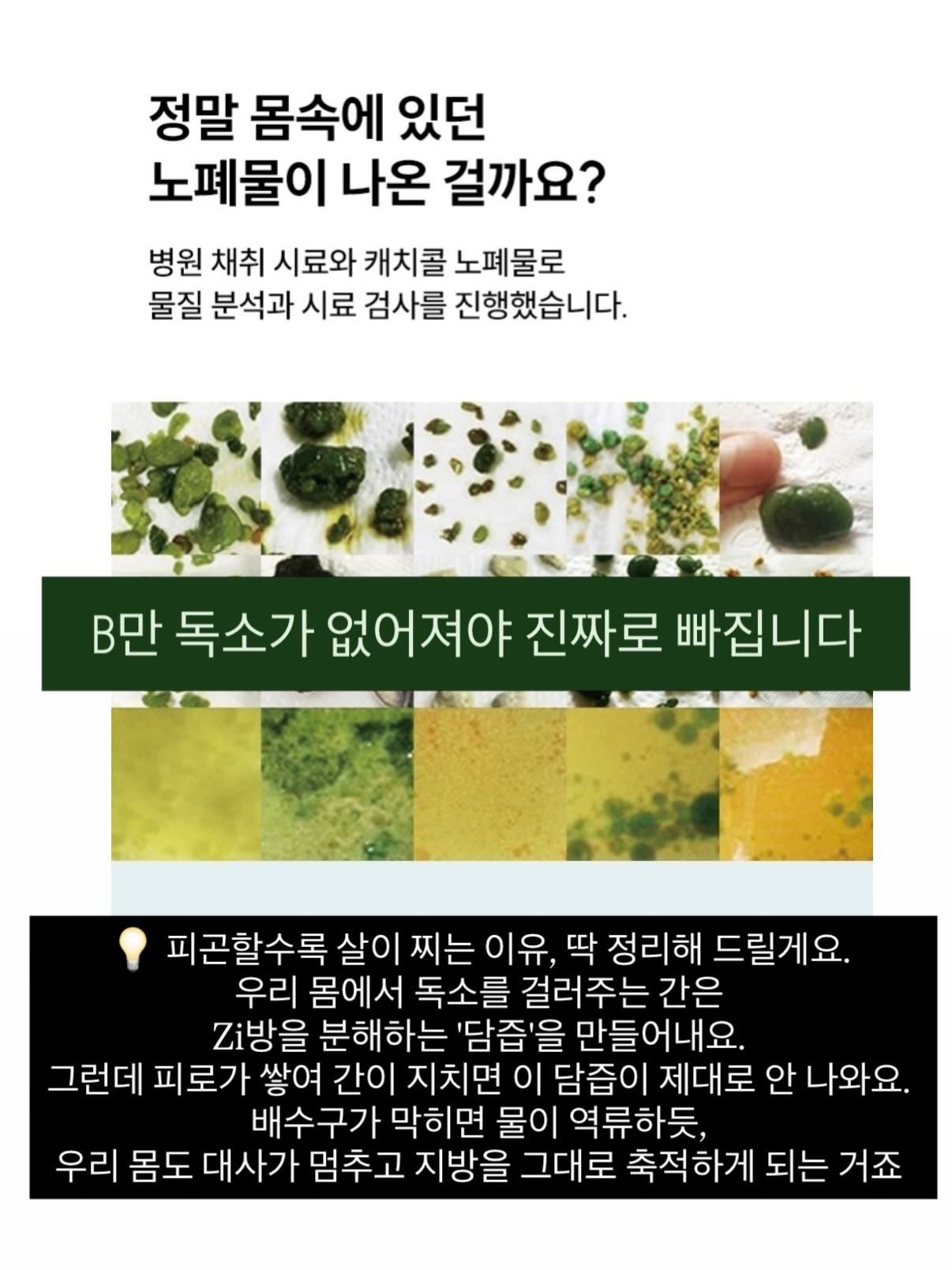 매그니유 캐치콜 라이트