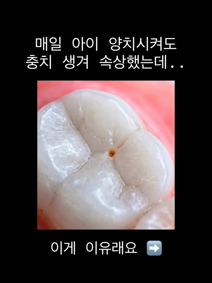 스마이즈 그래핀모 칫솔